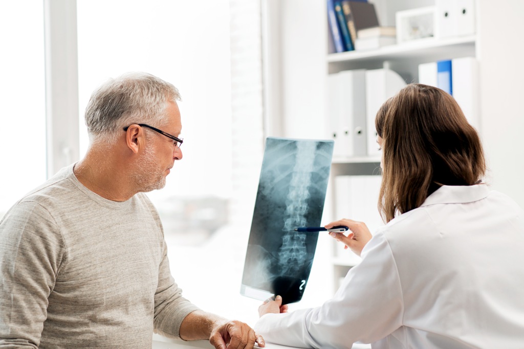 Eine Ärztin zeigt dem älteren Mann das Röntgenbild der Wirbelsäule