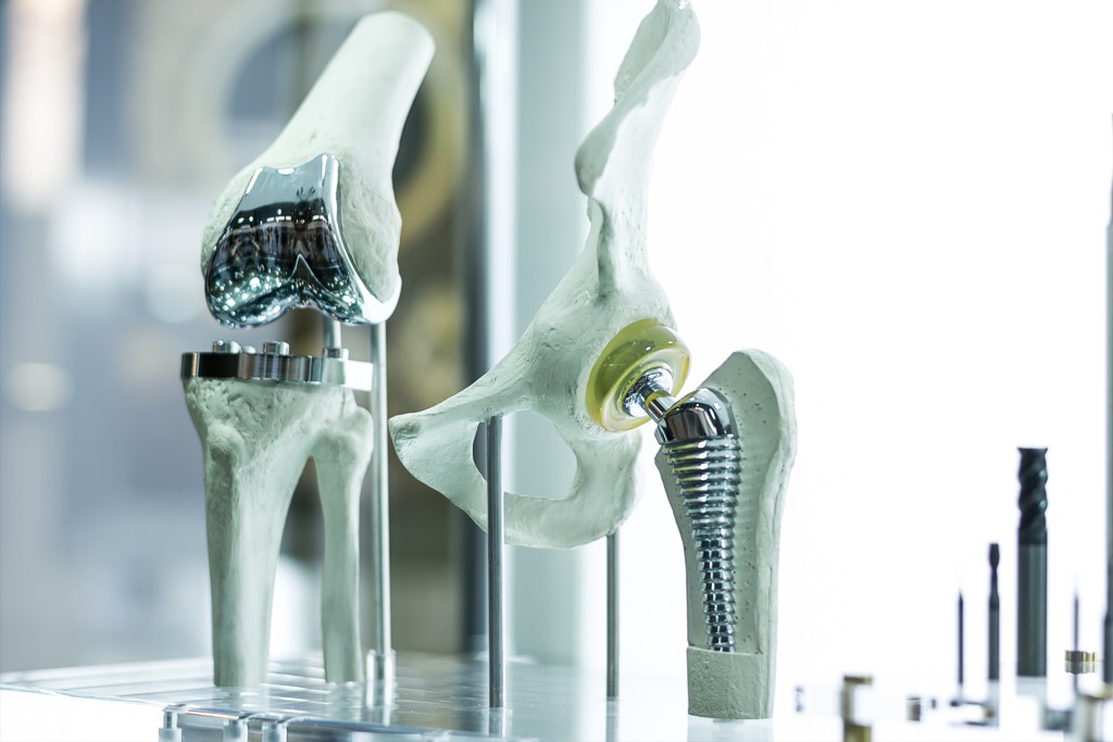 Künstliche Knie- und Hüftprothese Moderne Knie- und Hüftprothese
