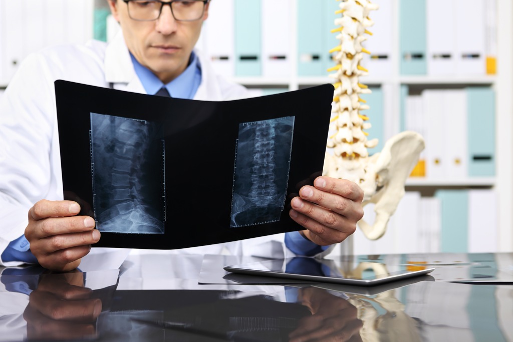 Ein Radiologe studiert eine Röntgenaufnahme der Wirbelsäule