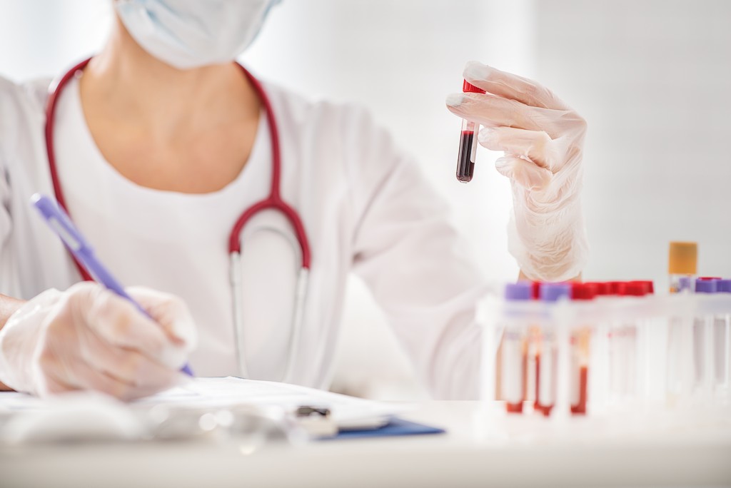 Osteoporose Blutuntersuchung Blutuntersuchung